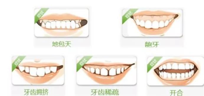 如何通过看牙齿判断运势好坏