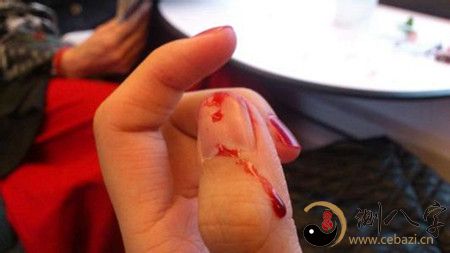 解梦 身体  手指流血,意味着着自己遭到来到一些意外事故,会给你的痛