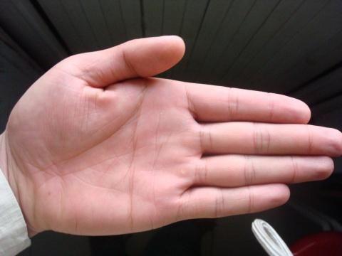 老中医手诊:看手掌心色调,身心健康安全隐患早知