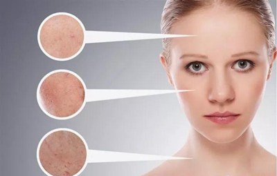 梦见脸部过敏严重