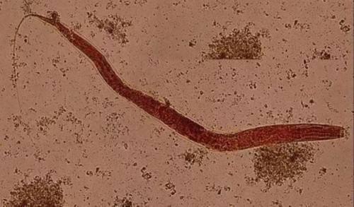 梦见从身体里拽出虫子