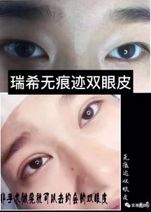 八字看双眼皮