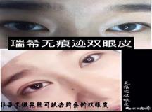 “八字看双眼皮-双眼皮在面相学代表