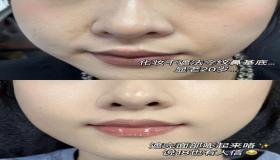 “八字丑里面是什么-丑在八字中代表