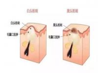 大六壬中什么叫闭口的意思